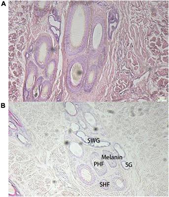 A comparative study of skin transcriptomes and histological observations for black and white hair colors of giant panda